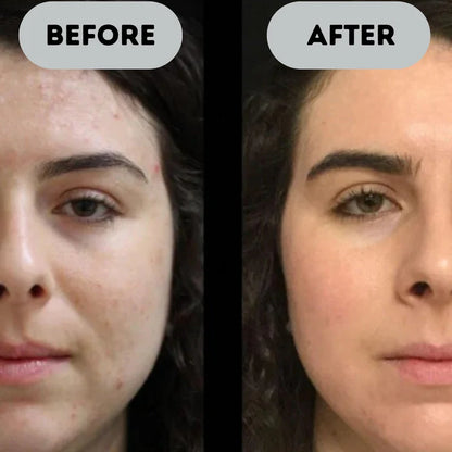 VitaLift™ - Anti-Aging Booster Pro